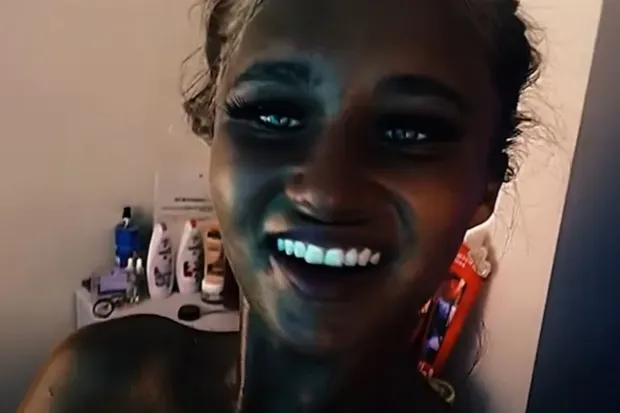 Megan Blain yagaragaje ingaruka uruhu rwe ruri kugira kubwo gukoresha sunbeds